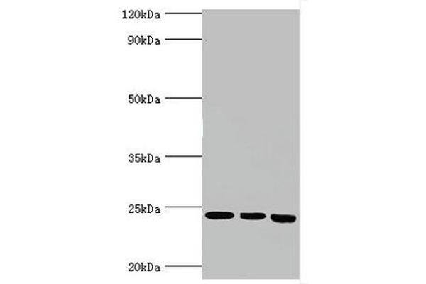 BAG2 anticorps  (AA 1-211)