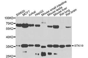 Western blot analysis of extracts of various cell lines, using STK19 antibody. (STK19 Antikörper  (AA 75-364))