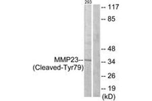 Western blot analysis of extracts from 293 cells, treated with etoposide 25uM 1h, using MMP23 (Cleaved-Tyr79) Antibody. (Matrix Metallopeptidase 23 (MMP23) (AA 60-109), (Cleaved-Tyr79) Antikörper)