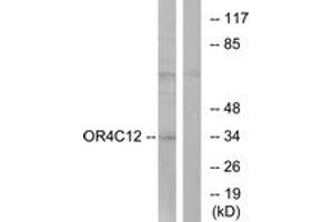 Western blot analysis of extracts from Jurkat cells, using OR4C12 Antibody. (OR4C12 Antikörper  (AA 260-309))