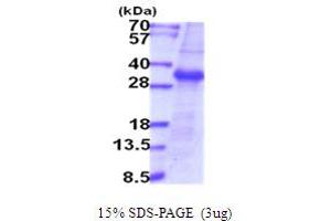SDS-PAGE (SDS) image for Transmembrane Protease, serine 15 (TMPRSS15) (AA 785-10199) protein (ABIN5778785) (TMPRSS15 Protein (AA 785-10199))