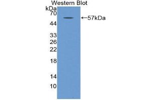 Western Blotting (WB) image for anti-Myosin Heavy Chain 2, Skeletal Muscle, Adult (MYH2) (AA 1238-1472) antibody (ABIN1859925) (MYH2 Antikörper  (AA 1238-1472))