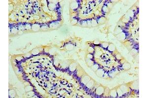 Immunohistochemistry of paraffin-embedded human small intestine tissue using ABIN7147728 at dilution of 1:100