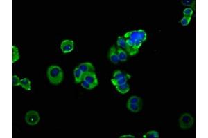 Immunofluorescence staining of MCF-7 cells with ABIN7150062 at 1:133, counter-stained with DAPI. (ADAM8 Antikörper  (AA 677-824))