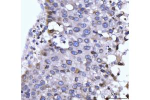 IHC analysis of GP210/NUP210 using anti-GP210/NUP210 antibody (ABIN7600707). (NUP210 Antikörper  (AA 221-1724))