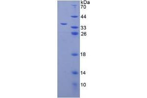 SDS-PAGE analysis of Human LMAN1 Protein.