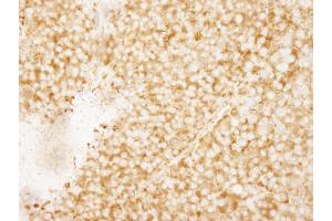 Immunohistochemistry (IHC) image for anti-RpL7a/SURF3 (C-Term) antibody (ABIN7449015) (RpL7a/SURF3 (C-Term) Antikörper)