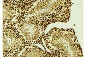 ABIN6276437 at 1/100 staining Mouse testis tissue by IHC-P. (BIRC2 Antikörper  (C-Term))