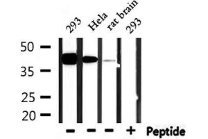 Western Blotting (WB) image for anti-Upstream Transcription Factor 2, C-Fos Interacting (USF2) (Internal Region) antibody (ABIN6265908)