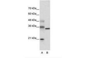 Image no. 1 for anti-Hairy and Enhancer of Split 4 (HES4) (AA 141-190) antibody (ABIN202081) (HES4 Antikörper  (AA 141-190))
