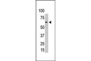 Western Blotting (WB) image for anti-Protein Inhibitor of Activated STAT, 2 (PIAS2) (AA 109-140), (N-Term) antibody (ABIN6242527)