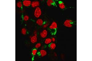 Immunofluorescence Analysis of human HePG2 cells labeling Albumin with Albumin Mouse Monoclonal Antibody (ALB/2355) followed by Goat anti-Mouse IgG-CF488 (Green). (Albumin Antikörper)