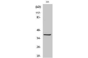 Western Blotting (WB) image for anti-Melanoma Antigen Family C, 2 (MAGEC2) (Internal Region) antibody (ABIN3185441)