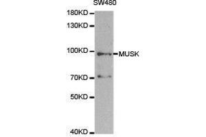 Western Blotting (WB) image for anti-Muscle, Skeletal, Receptor Tyrosine Kinase (MUSK) antibody (ABIN1873783) (MUSK Antikörper)