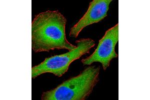 Fluorescent confocal image of Hela cell stained with Tuberin (TSC2) Antibody  (ABIN390324 and ABIN2840755). (Tuberin Antikörper  (AA 1776-1805))