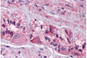 Image no. 1 for anti-Cholinergic Receptor, Nicotinic, alpha 3 (Neuronal) (CHRNA3) (AA 35-84) antibody (ABIN6747008)