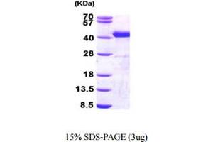 SDS-PAGE (SDS) image for Sorbitol Dehydrogenase (SORD) (AA 1-357) protein (His tag) (ABIN667008)
