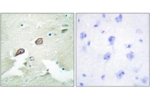 Immunohistochemistry analysis of paraffin-embedded human brain tissue, using HER3 (Ab-1222) Antibody. (ERBB3 Antikörper  (AA 1191-1240))