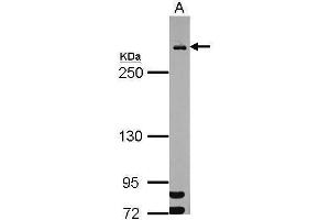WB Image Sample (30 ug of whole cell lysate) A: HeLa nucleus 5% SDS PAGE antibody diluted at 1:1000 (MDC1 Antikörper)