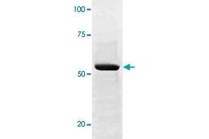 The whole cell lysate derived from conditioned LNCaP were immunoblotted SOX9 (phospho S181) polyclonal antibody  at 1 : 500.