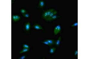 Immunofluorescent analysis of Hela cells using ABIN7161979 at dilution of 1:100 and Alexa Fluor 488-congugated AffiniPure Goat Anti-Rabbit IgG(H+L) (NOP58 Antikörper  (AA 1-529))