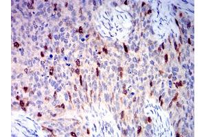 Immunohistochemistry (IHC) image for anti-Aurora Kinase A (AURKA) (AA 268-404) antibody (ABIN5611121)