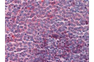 Human Spleen: Formalin-Fixed, Paraffin-Embedded (FFPE)