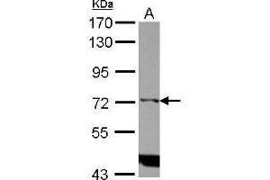 WB Image Sample (30 ug of whole cell lysate) A: Raji 7. (ITPKC Antikörper)