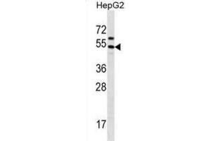 Western Blotting (WB) image for anti-Grainyhead-Like 1 (GRHL1) antibody (ABIN2998692)