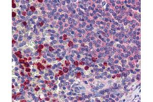 Immunohistochemistry (IHC) image for anti-C-Type Lectin Domain Family 2, Member D (CLEC2D) (AA 1-155) antibody (ABIN790667)