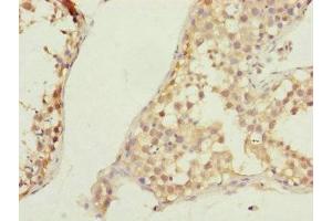 Immunohistochemistry of paraffin-embedded human testis tissue using ABIN7147449 at dilution of 1:100 (CSPP1 Antikörper  (AA 997-1256))