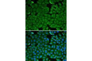 Immunofluorescence analysis of HeLa cell using SPINK1 antibody. (SPINK1 Antikörper)