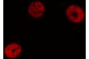 ABIN6274297 staining HeLa cells by IF/ICC. (DLX5 Antikörper  (Internal Region))