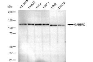 Western blotting analysis using GABBR2 antibody (ABIN7798691).