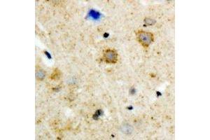 Immunohistochemical analysis of GRK3 staining in human brain formalin fixed paraffin embedded tissue section. (ADRBK2 Antikörper)