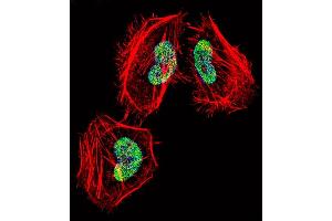 Fluorescent confocal image of Hela cell stained with HDAC4 Antibody (C-term) (ABIN657638 and ABIN2846634). (HDAC4 Antikörper  (C-Term))