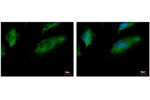 ICC/IF Image CoCoA antibody [N2C2], Internal detects CALCOCO1 protein at cytoplasm by immunofluorescent analysis. (CALCOCO1 Antikörper)