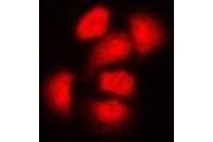 Immunofluorescent analysis of ASC-1 staining in Hela cells.