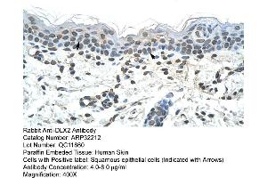 Human Skin (DLX2 Antikörper  (C-Term))