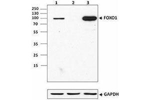 Western Blotting (WB) image for anti-Forkhead Box O1 (FOXO1) antibody (ABIN2664978) (FOXO1 Antikörper)
