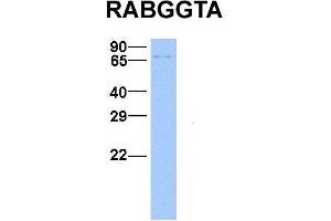 Host:  Rabbit  Target Name:  RABGGTA  Sample Type:  Hela  Antibody Dilution:  1. (RABGGTA Antikörper  (N-Term))
