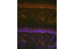 Immunofluorescence analysis of Mouse tail and ear using Cytokeratin 16 (KRT16) Rabbit mAb (ABIN7268094) at dilution of 1:100 (40x lens). (KRT16 Antikörper)