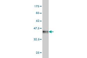 Western Blot detection against Immunogen (40. (TESK2 Antikörper  (AA 405-542))