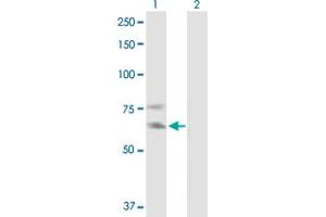 Western Blot analysis of IL2RB expression in transfected 293T cell line by IL2RB MaxPab polyclonal antibody. (IL2 Receptor beta Antikörper  (AA 1-551))