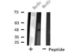 Western blot analysis of extracts from HuvEc cells, using ZNF446 antibody.