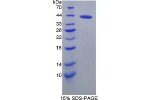 Image no. 1 for Brevican (BCAN) (AA 23-353) protein (His tag) (ABIN6238304) (BCAN Protein (AA 23-353) (His tag))