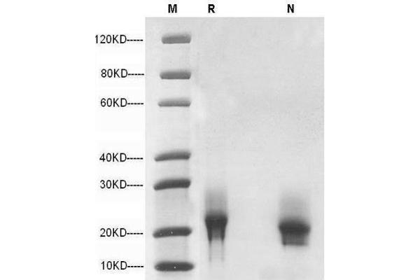 GM-CSF Protein (AA 18-141)