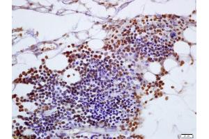 Formalin-fixed and paraffin embedded mouse pancreas labeled with Anti-FAM129A Polyclonal Antibody, Unconjugated (ABIN717701) at 1:200 followed by conjugation to the secondary antibody and DAB staining (Niban Antikörper  (AA 455-550))