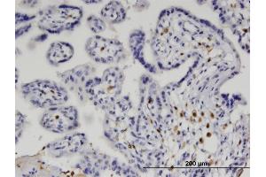 Immunoperoxidase of monoclonal antibody to IRF5 on formalin-fixed paraffin-embedded human placenta. (IRF5 Antikörper  (AA 1-498))