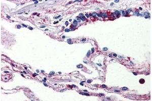 Human Lung (formalin-fixed, paraffin-embedded) stained with C5AR1 antibody ABIN461687 followed by biotinylated goat anti-rabbit IgG secondary antibody ABIN481713, alkaline phosphatase-streptavidin and chromogen. (C5AR1 Antikörper  (Internal Region))